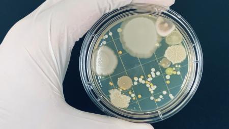 IST16 - Advanced course on Microbial MultiOmics